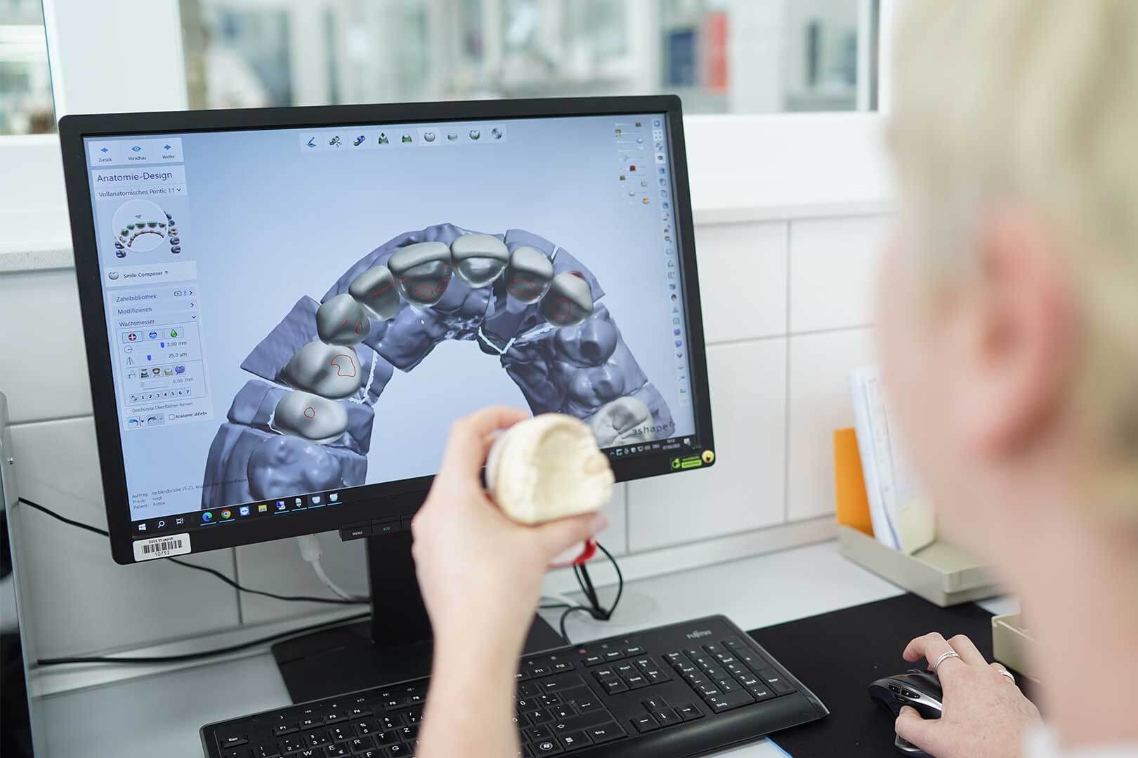digitaler Zahnabdruck im Rahmen des digitalen Workflow im Dentallabor
