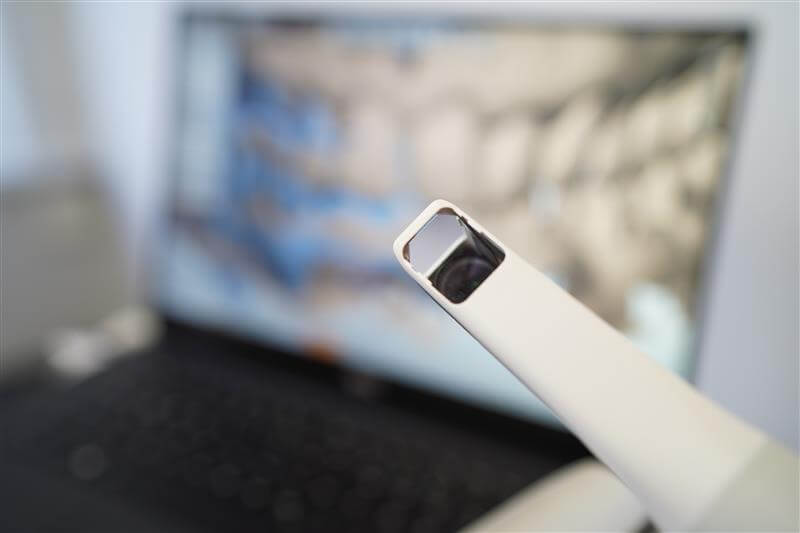 Seitenansicht eines modernen, weißen Intraoralscanners zur digitalen Gebissabformung vor einem unscharfen Hintergrund.