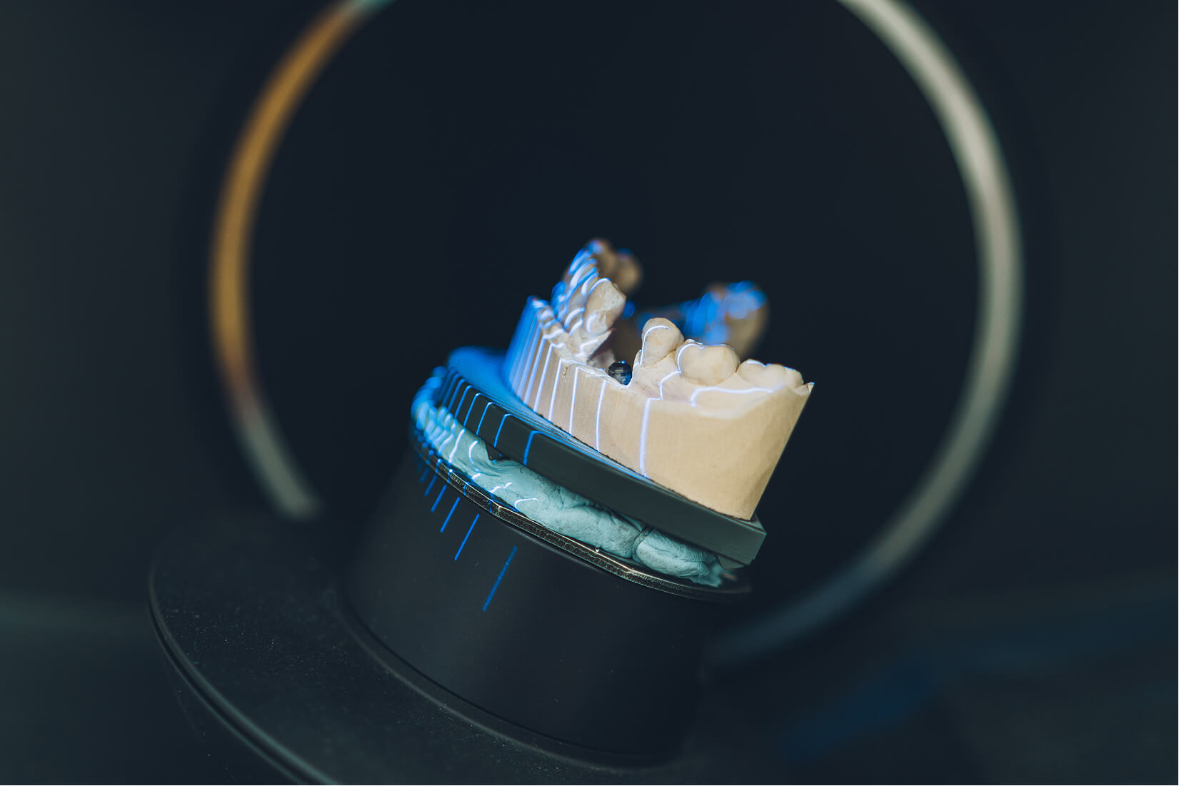 Hochpräziser Dental-3D-Scanner bei der Erfassung eines Gebissmodells im Dentallabor.