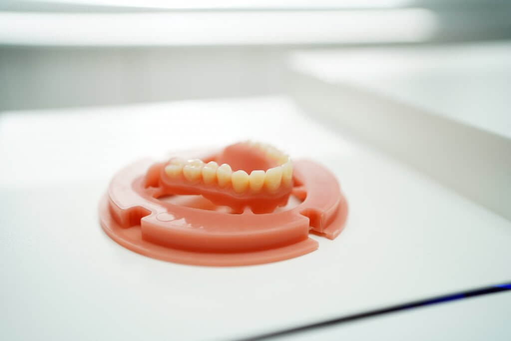 Zahnersatz vom Zahnlabor Voigt Dental